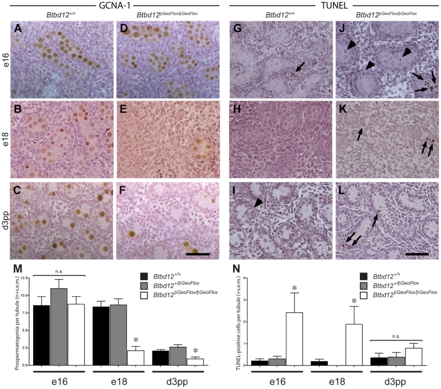 Spermatogonial germ cell proliferation in prepubescent males.