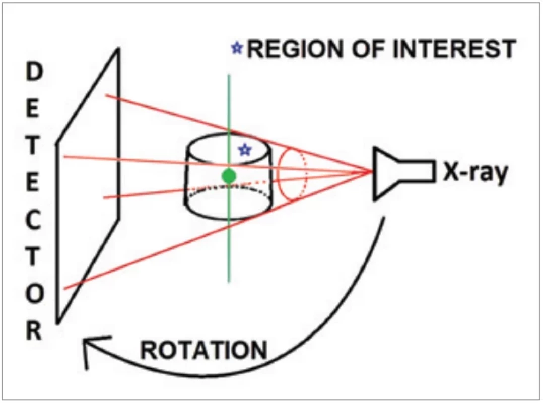 Principle of cone beam computed tomography.