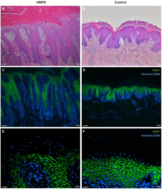Nasal planum tissue of an HNPK affected and a non-affected Labrador Retriever.