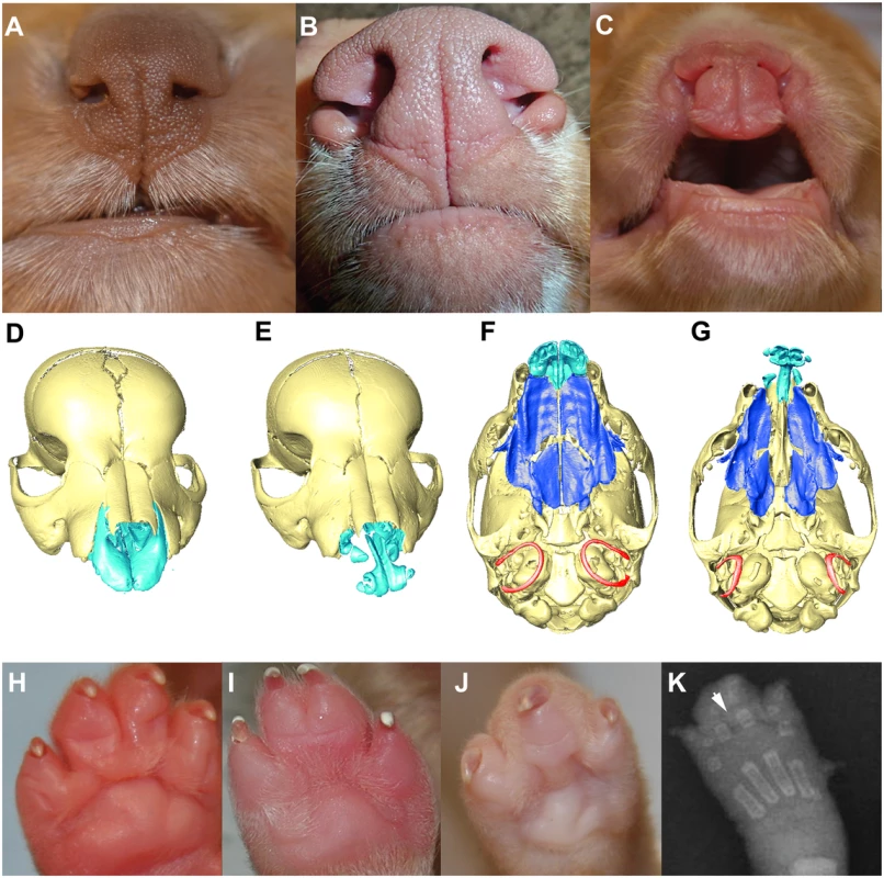 Phenotypic spectrum of CLPS in NSDTRs.