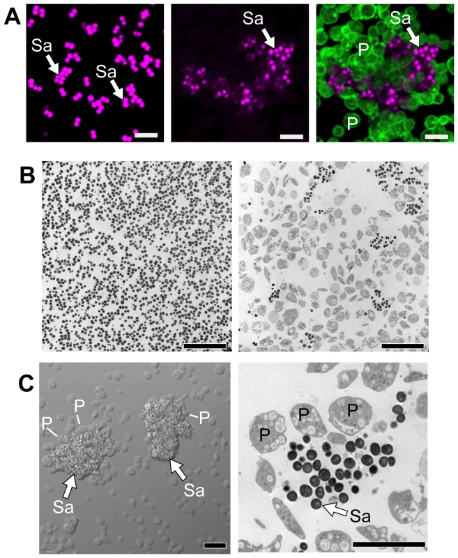 Platelets sequester <i>S. aureus</i>.