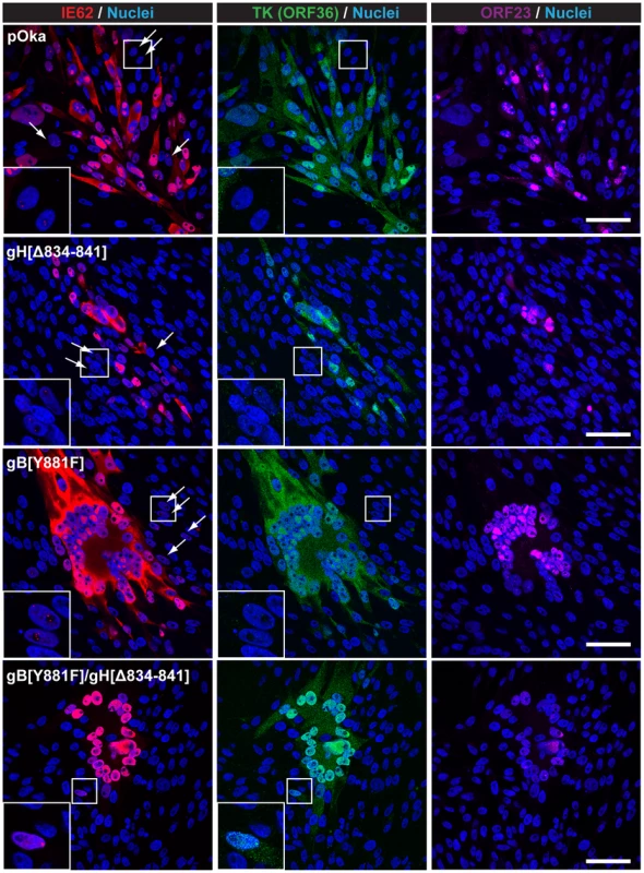 Dual mutant gB[Y881F]/gH[Δ834-841] BAC induces exaggerated syncytia formation.