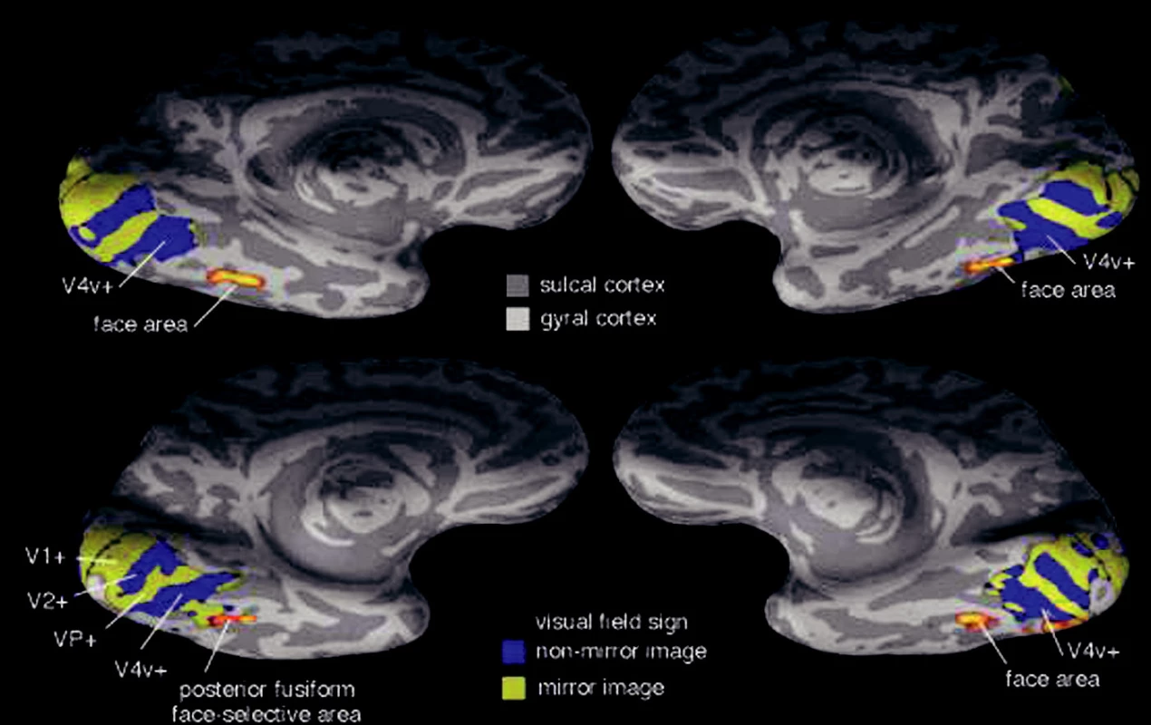 Laterální a ventrální pohled na pravou a levou hemisféru
Sulcal cortex kůra rýh mezi závity
Gyral cortex kůra závitů
Face area tvářová oblast
Posterior fusiform … oblast zadní části g. fusiformis aktivovaná při prohlížení tváří
