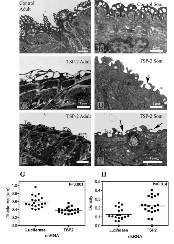 Ultrastructure of the tegument of parasites treated with <i>Sm-tsp-2</i> dsRNA RNA observed using transmission electron microscopy.