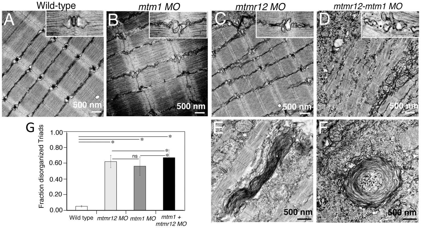 Ultrastructural abnormalities in <i>MTMR12</i> deficiency.