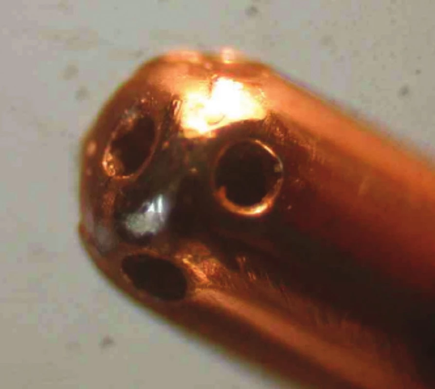 5dírková aspirační sonda – detail zakončení s 5 otvory o průměru 0,1mm. Podle našeho návrhu ji vyrobila firma Geuder.