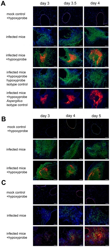 Identification of hypoxic microenvironments at the site of <i>A. fumigatus</i> infections in murine lungs.