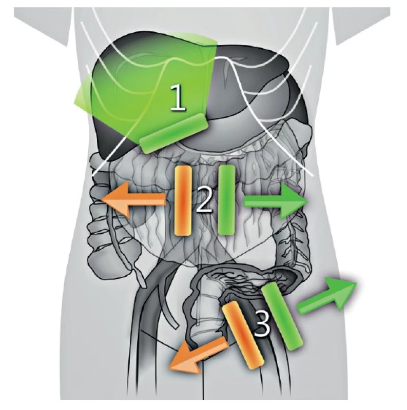 Postup u transabdominálního ultrazvuku