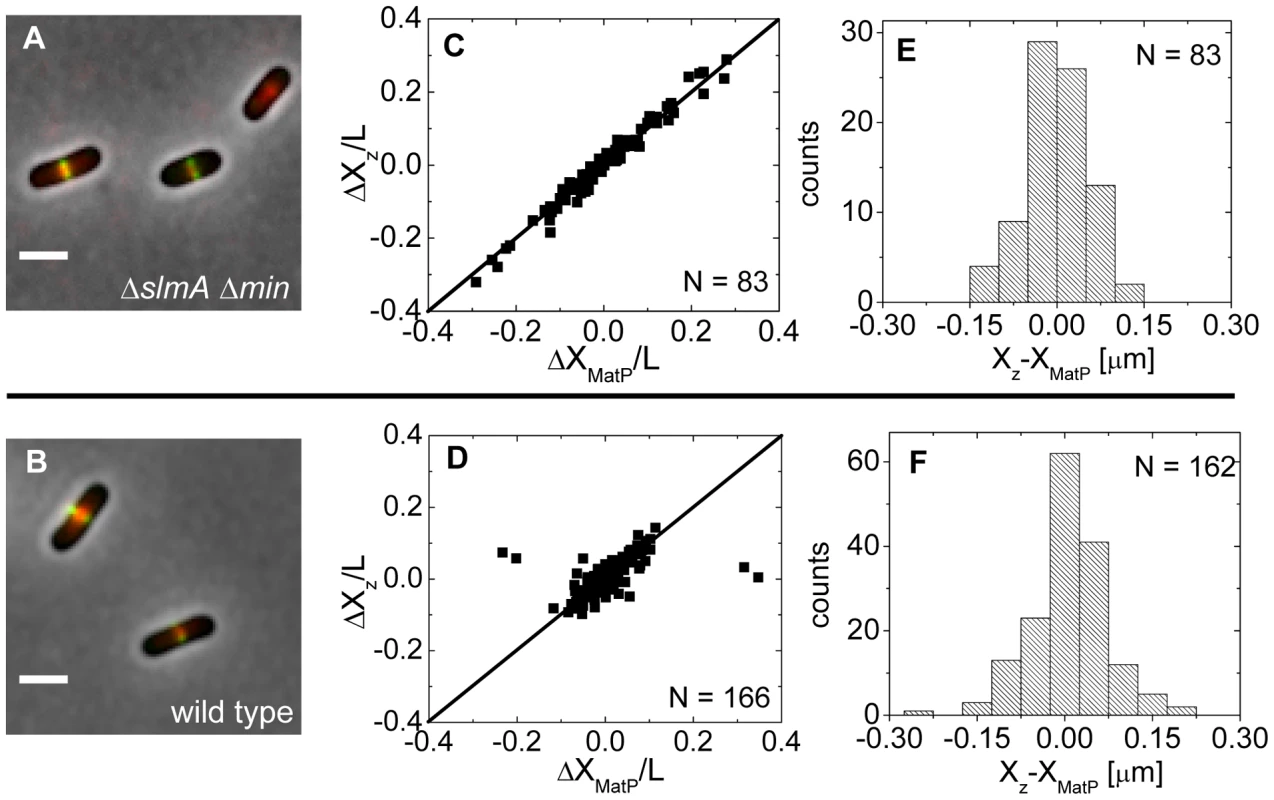 Positioning of the Z-ring relative to the MatP-labeled Ter macrodomain.