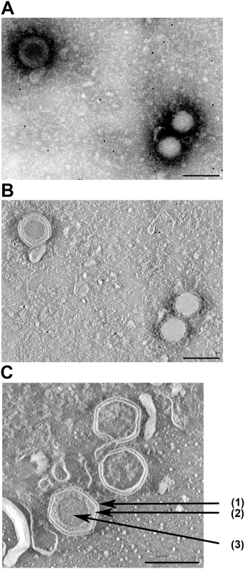 Electron microscopy of SDDV.