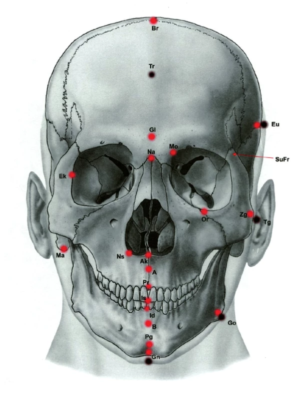 Ukázka antropometrických bodů – frontální pohled na lebku. Většina z nich se stala základem konstrukce kefalometrických analýz. (Převzato z knihy Klinická anatomie pro stomatology, Ivo Klepáček, Jiří Mazánek a kolektiv, Grada, Avicenum, 2001.) Br-bregma, Tr-trichion, Gl-glabella, Na-nasion, Momedioorbitale, Eu-Euryon, SuFr-sutura frontozygomatica, Ek-ektokonchion,Or-orbitale, Zg-zygion,Tg-tragion, Ns-nasospinale, Ma-mastoideale, Ak-akanthion, A-bod A, B-bod B, Pr-prosthion, Is-incisale superius, Id-infradentale, Pg-pogonion, Gn-gnathion, Go-gonion, Opopisthocranion, Po-porion,Ar-articulare, Ge-genion, Lilabrale inferius, Ls-labrale superius, Sto-stomion, Sn-subnasale.