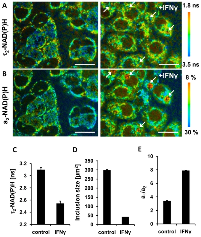 Effects of IFNγ treatment on NAD(P)H inside chlamydial inclusions.