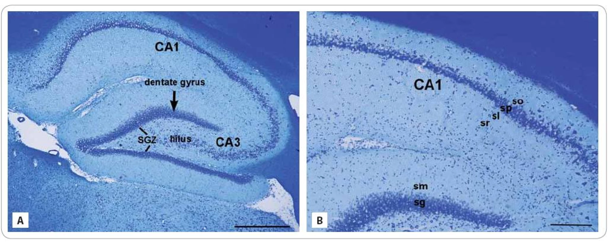 Cresyl violet stained photomicrographs of the sagittal sections through the hippocampus of adult control rat composed of two regions: the dentate gyrus and subfields of the cornu ammonis region: CA1 and CA3 (A). The lines showed the subgranular zone (SGZ), a narrow layer between stratum granulosum and the hilus. (A) Detail of the CA layers (from inside-out): stratum radiatum (sr), str. lucidum (sl), str. pyramidale (sp), and str. oriens (so) and the DG layers: str. moleculare (sm) and str. granulosum (sg) (B).