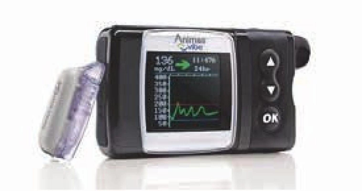 Kombinace inzulínové pumpy a CGM – Animas Vibe (Johnson &amp; Johnson, USA).