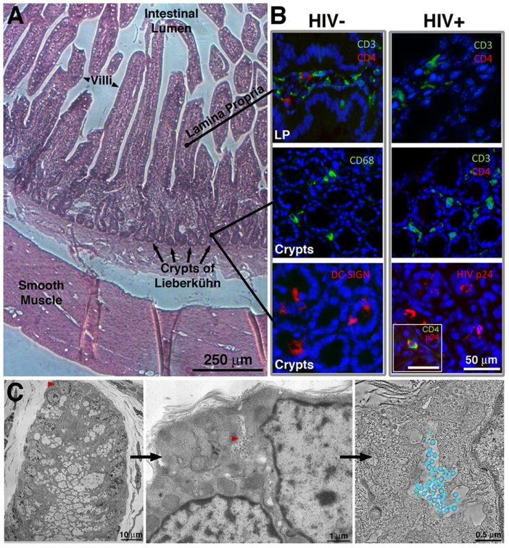 IF and EM imaging of BLT mouse GALT.