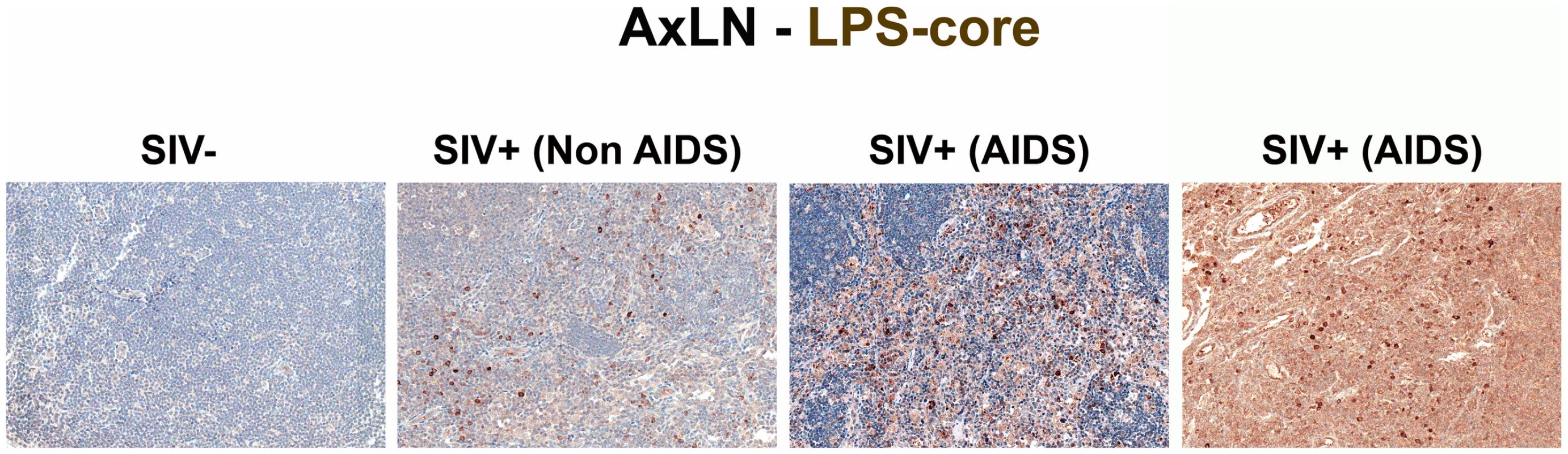 Identification of systemic microbial translocation in distant AxLN of chronically SIV<sup>+</sup> RMs.