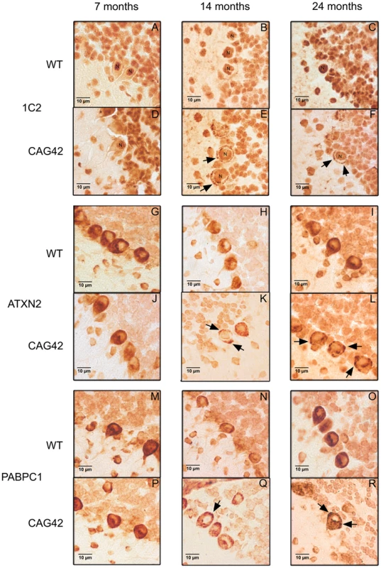 Immunohistochemistry of cerebellar Purkinje cells.