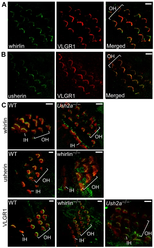 Whirlin, usherin and VLGR1 are colocalized in stereocilia of inner ear hair cells at postnatal day 4.