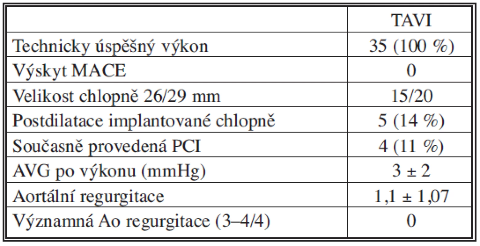 Výsledky TAVI
Tab. 3. TAVI outcomes