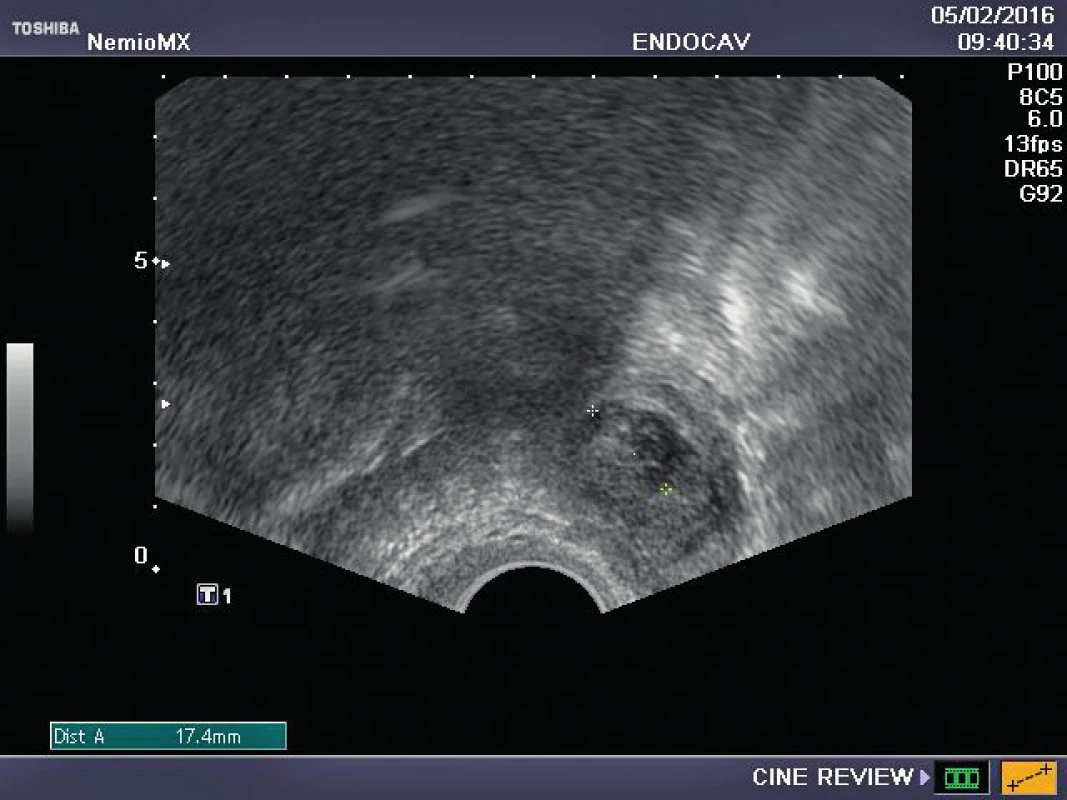 Corpus luteum