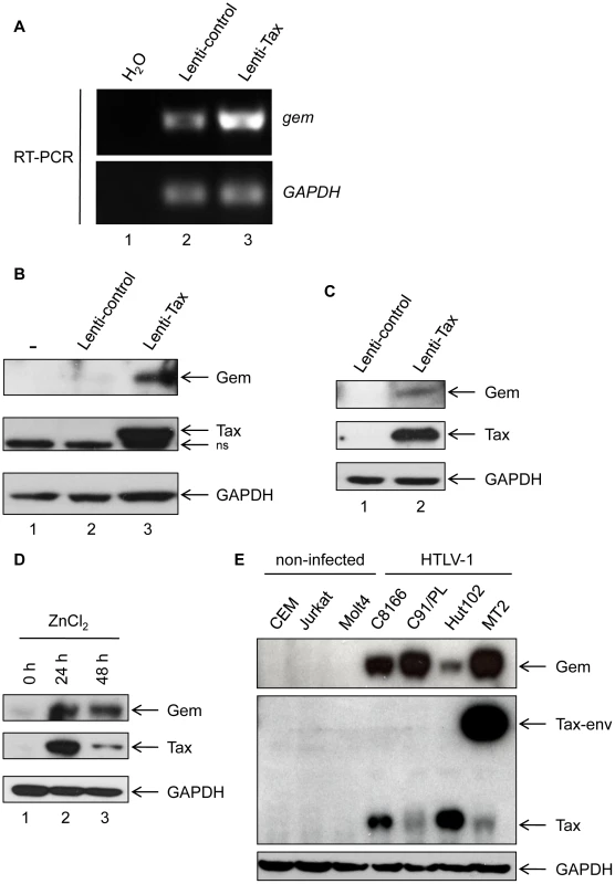 Gem is overexpressed in T- and non-T-Tax-expressing cells as well as in HTLV-1 infected cells.