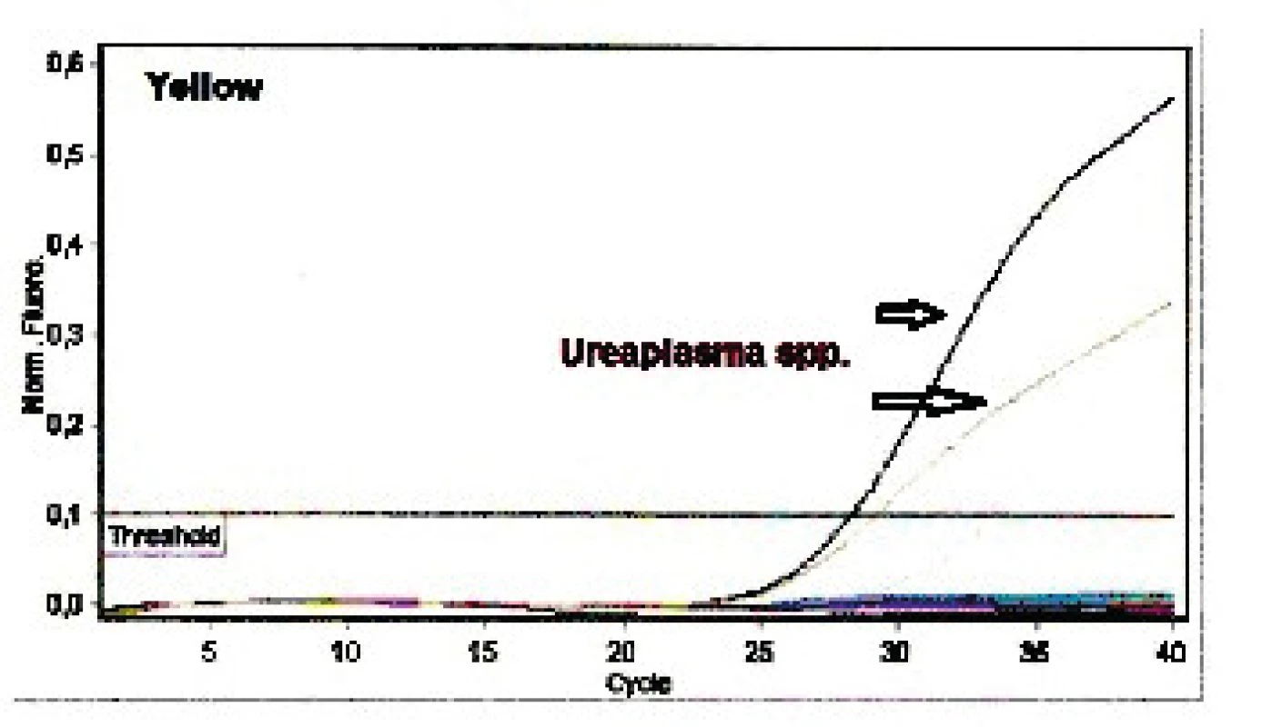 Výstup rt-PCR <i>Ureaplasma</i> spp.