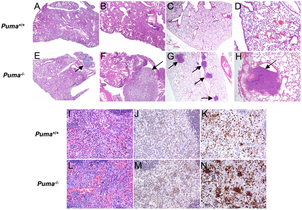 Histopathology of bacterial-infected organs.