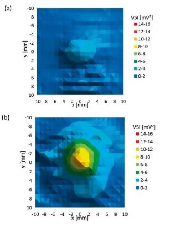 Planar xy scan behind particular culture dish (a) glass culture dish, (b) plastic culture dish (40 mm diameter).