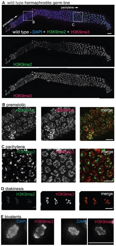 H3K9me2 and H3K9me3 localization in the adult hermaphrodite germ line.
