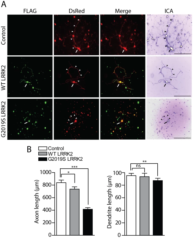 Effects of LRRK2 expression on neurite length of cortical neurons.