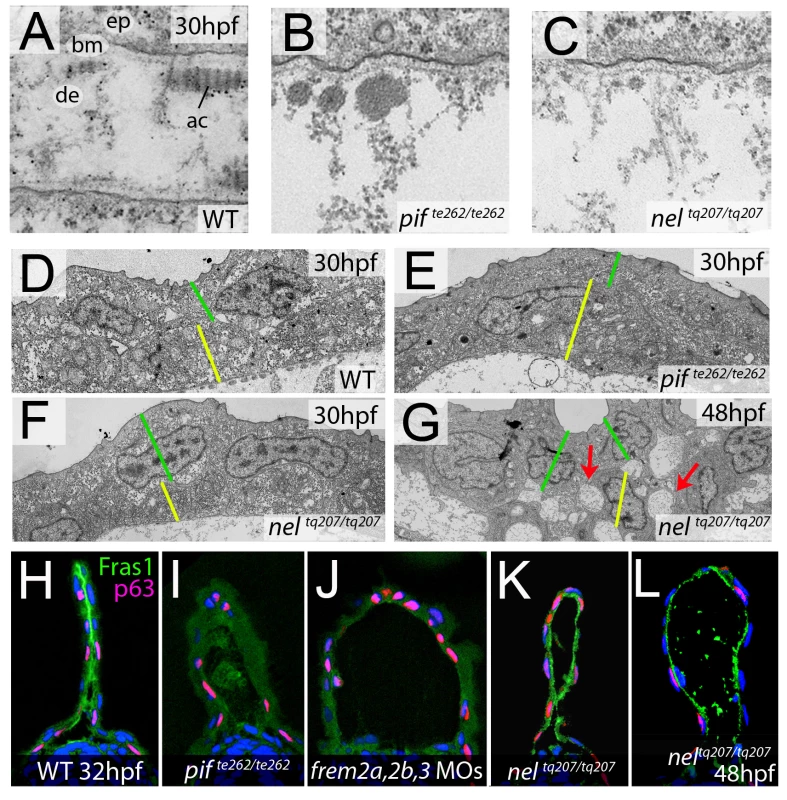 <i>fras1</i> and <i>hmcn1</i> mutants display blister formation at identical sites below the basement membrane; however, in contrast to Frem2/3 proteins, Hmcn1 is dispensable for Fras1 stabilisation.
