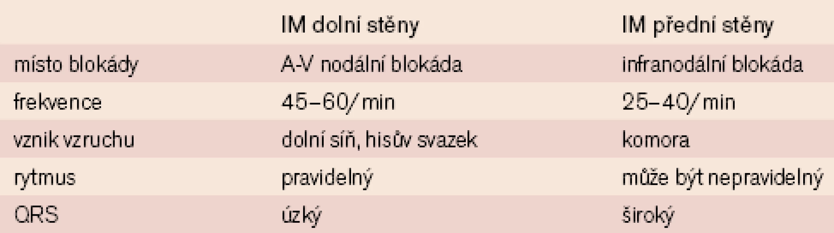 EKG známky AVB III. st. u IM dolní stěny a přední stěny [5].