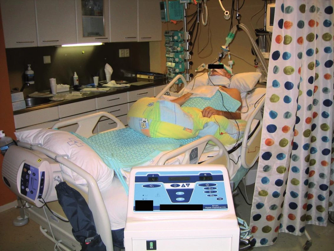 Matracový ochlazovací systém s cirkulací vody Blanketrol III, Cincinnati
Sub-Zero Products, Inc., Cincinnati, USA. Z databáze Kardiologického oddělení Krajské nemocnice Liberec, a.s., s laskavým svolením MUDr. P. Telekese.