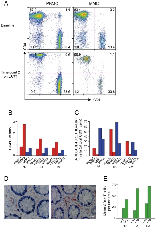 Immunological profiles of experimental patients before and after initiation of cART.