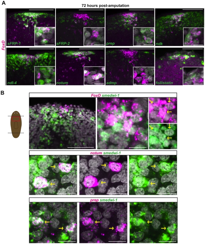<i>FoxD</i> is expressed in anterior pole progenitors.