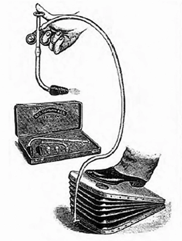 Fell-O’Dwyerův aparát
Fig. 6: Fell-O’Dwyer apparatus