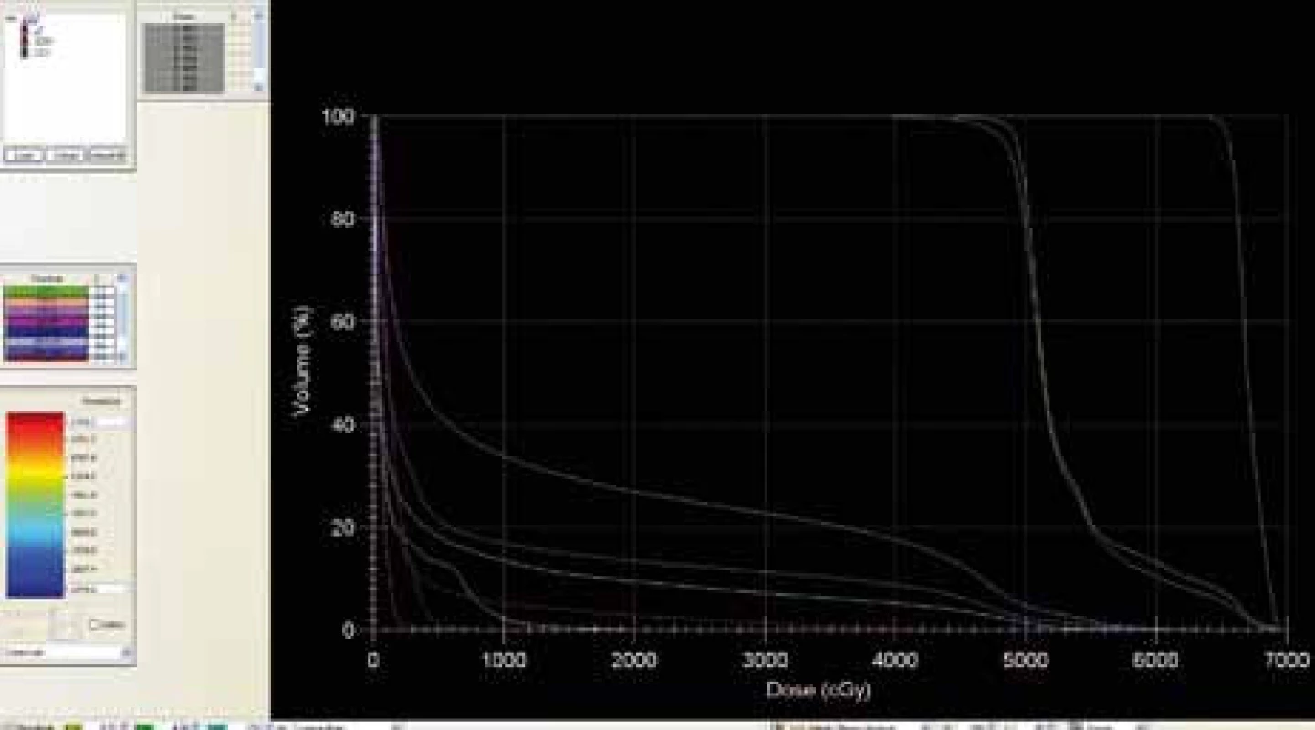 Dose-volume histogram s použitím ABC zařízení.