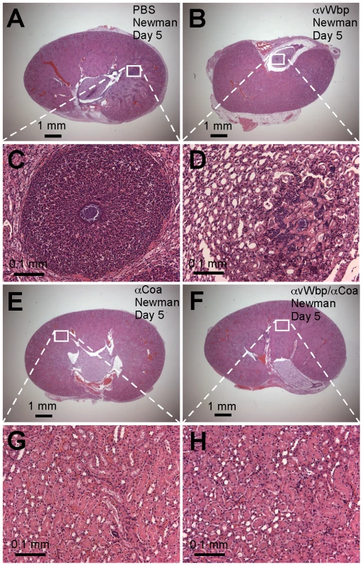 Passive transfer of coagulase antibodies confers protection against <i>S. aureus</i> abscess formation.