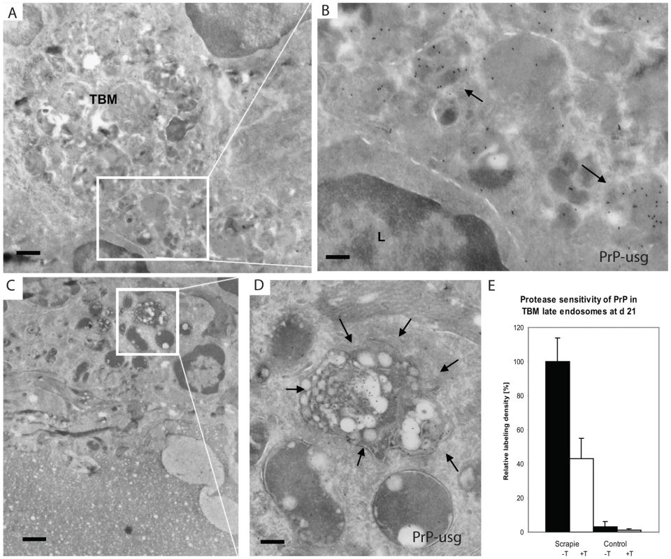 PrP positive endosomes in the germinal centre of Peyer's patch of wt mouse exposed to ME7 prions.