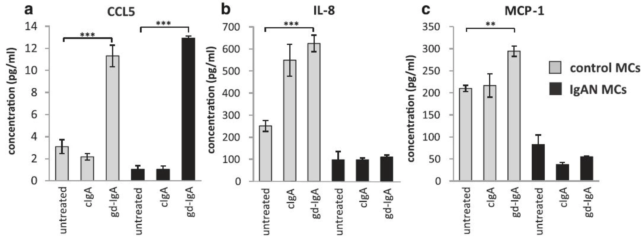 Release of CCL5, IL-8 and MCP-1. Mesangial cells (MCs) from patients with IgA nephropathy (IgAN) and controls were stimulated with IgA1 purified from blood from healthy controls (cIgA) or patients with IgAN (gd-IgA) or medium only for 24 h and the release of cytokines into the medium was investigated. Stimulation of control MCs and IgAN MCs with gd-IgA resulted in an increased release of CCL5 in both groups of cells, in contrast stimulation with cIgA did not affect either group of cells at all (a). Only the control MCs responded to treatment with gd-IgA with an increased release of IL-8 (b) and MCP-1 (c). <i>Grey bars</i> represent control MCs, <i>black bars</i> represent IgAN MCs * <i>P</i> < 0.05, ** <i>P</i> < 0.01, *** <i>P</i> < 0.001, error bars represent SEM