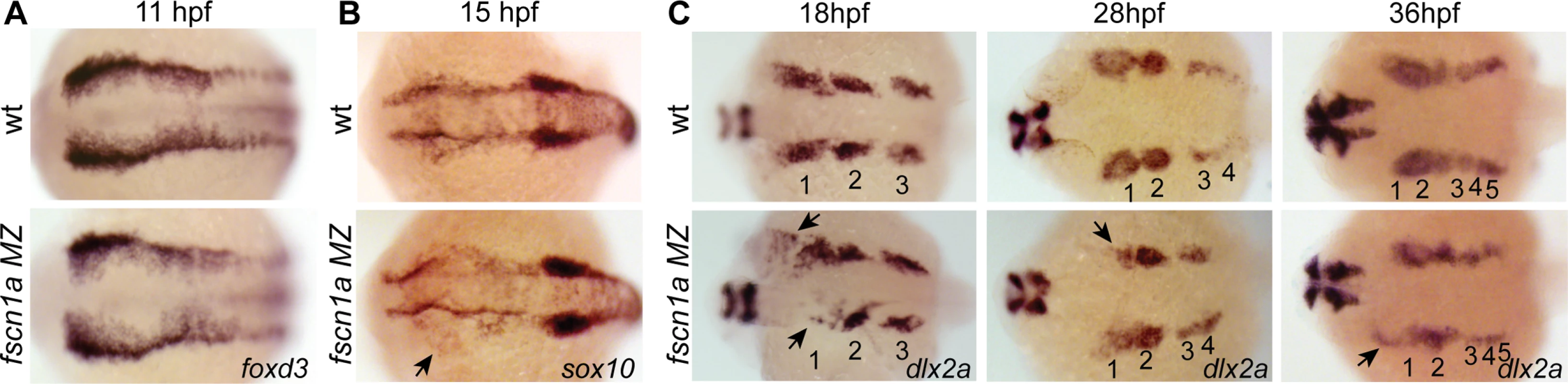 <i>fscn1a</i> is required for collective migration of the first NC stream.