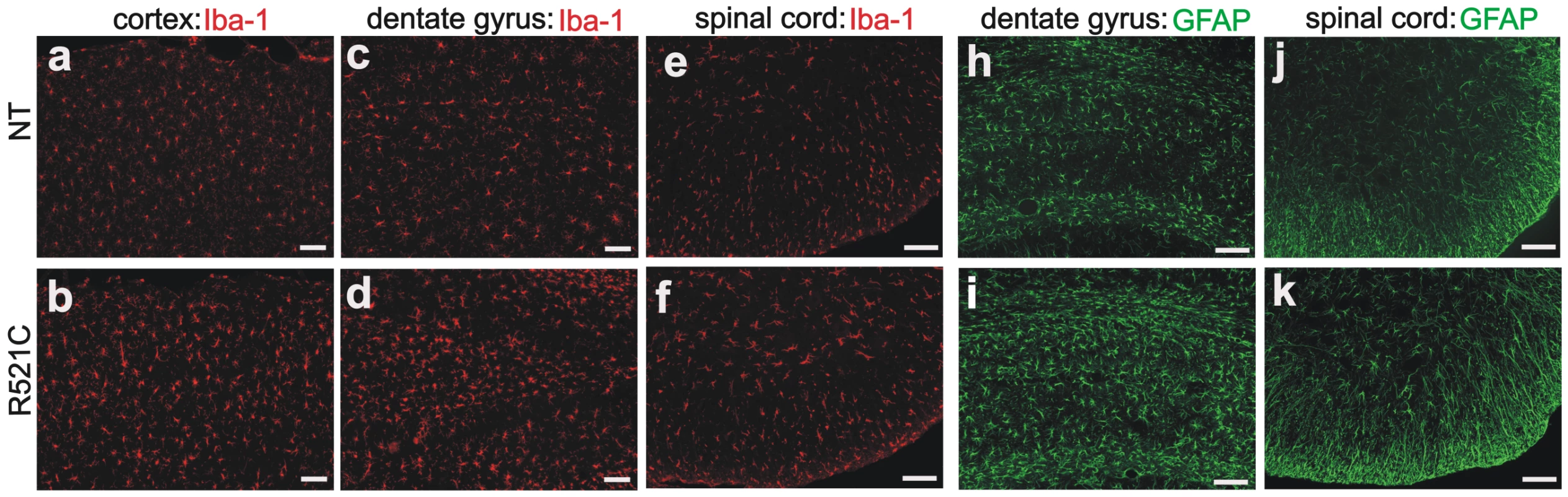 Proliferation of astrocytes and microglia in mutant FUS transgenic rats.