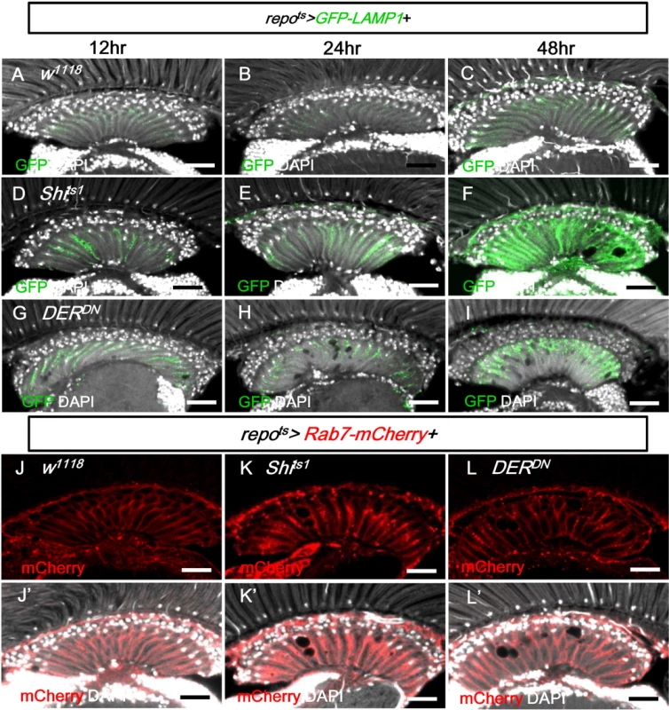 EGFR signaling is required for endo-lysosomal trafficking.