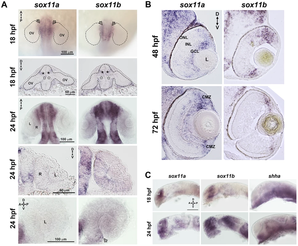 Developmental expression of <i>sox11</i>.