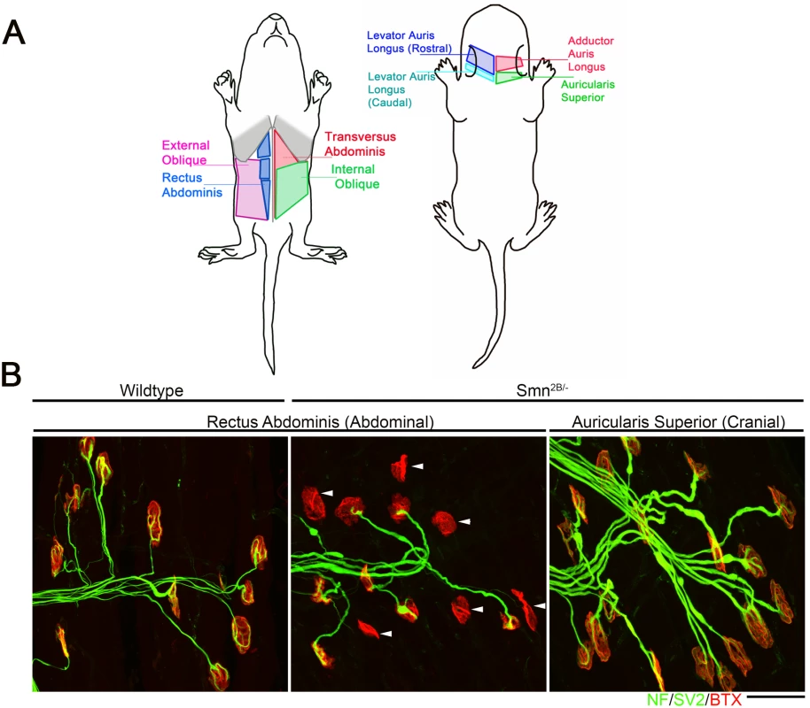 Intermuscular variability in the levels of neuromuscular junction pathology in the Smn<sup>2B/-</sup> mouse model of SMA.