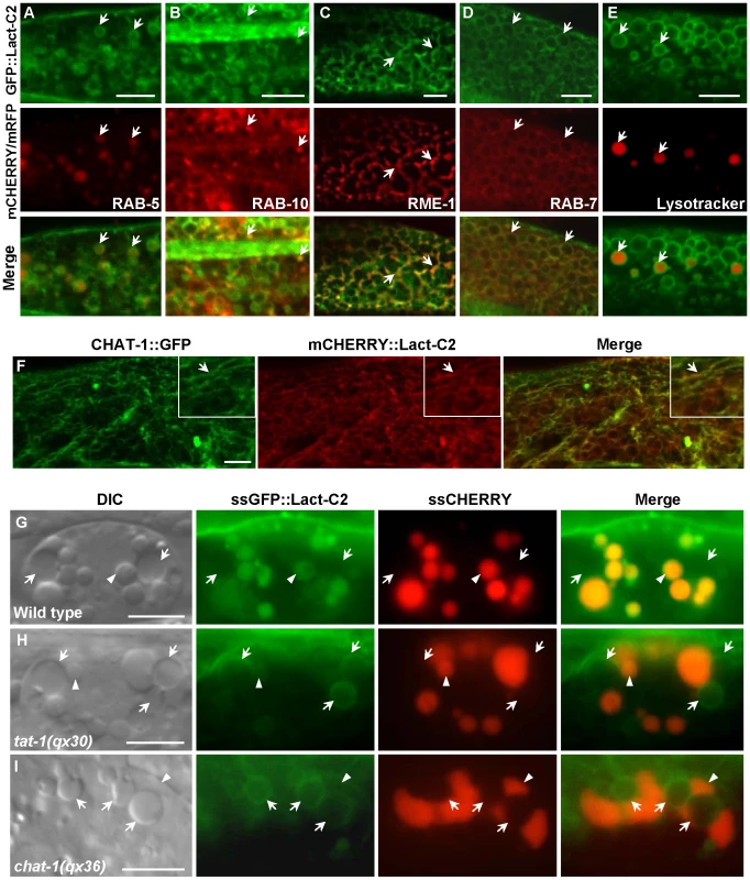 Endomembrane PS asymmetry is disrupted in <i>tat-1</i> and <i>chat-1</i> mutants.