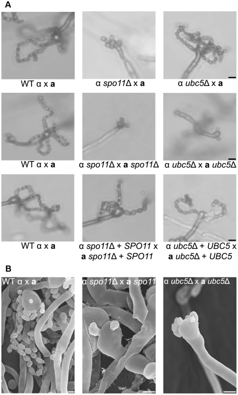 Spo11 and Ubc5 are necessary for sporulation during bisexual reproduction.