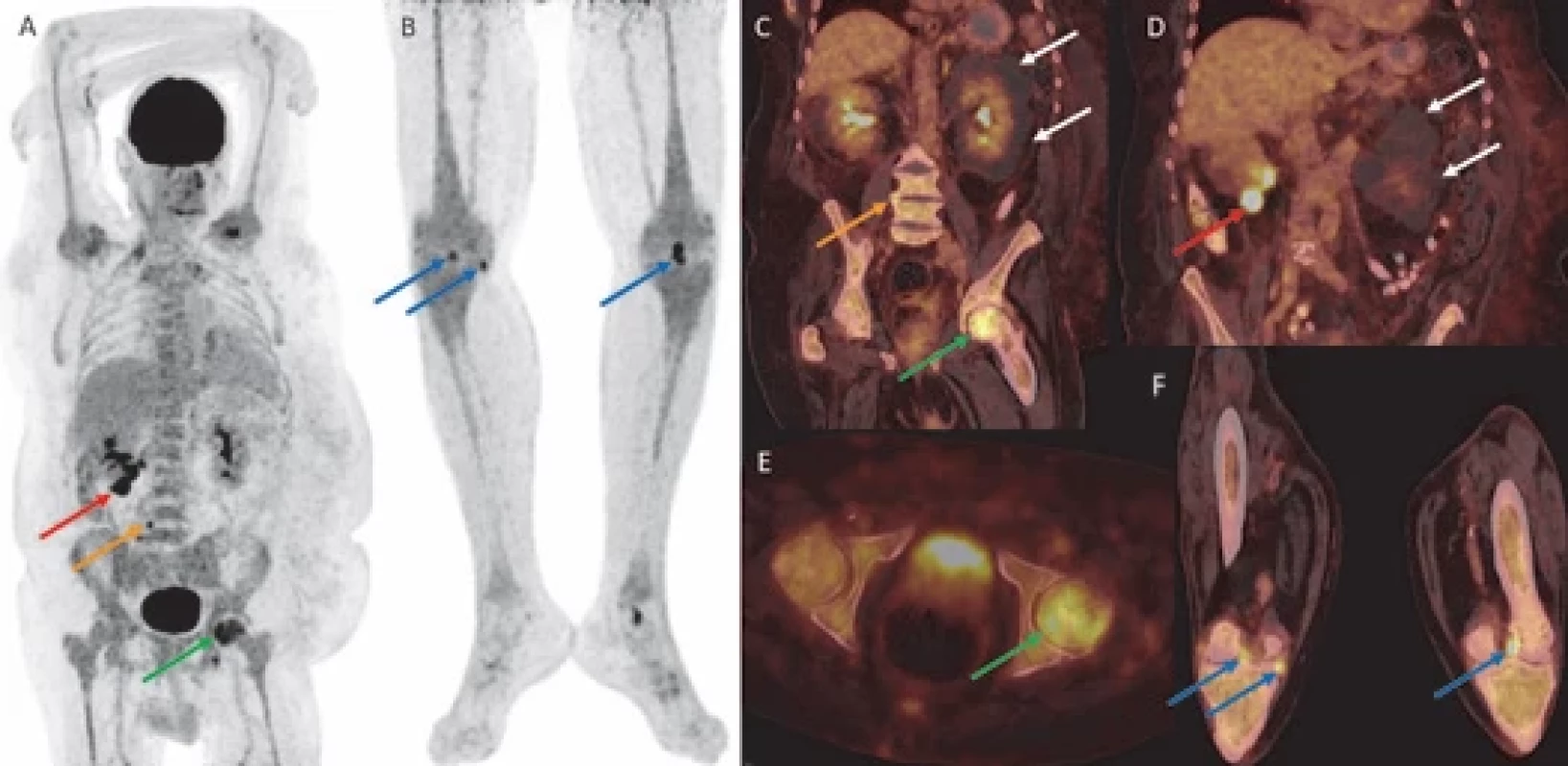FDG-PET/CT.