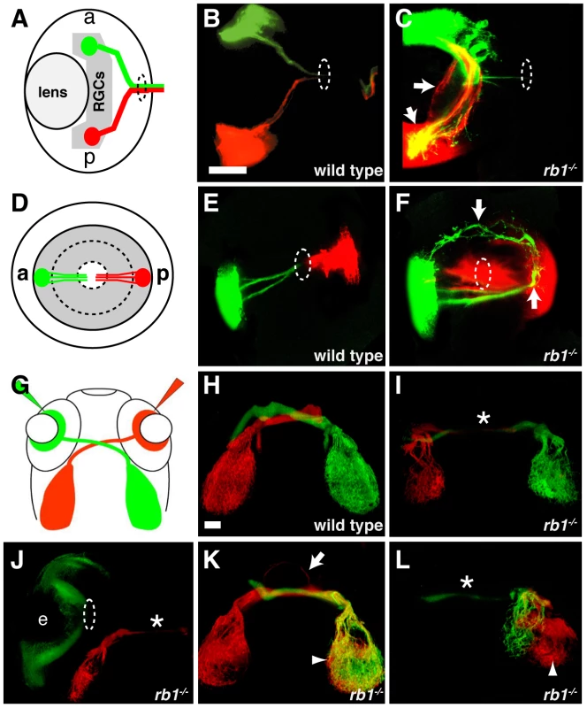 Intraretinal and midline RGC axon pathfinding errors in <i>rb1<sup>te226a</sup></i> mutants.