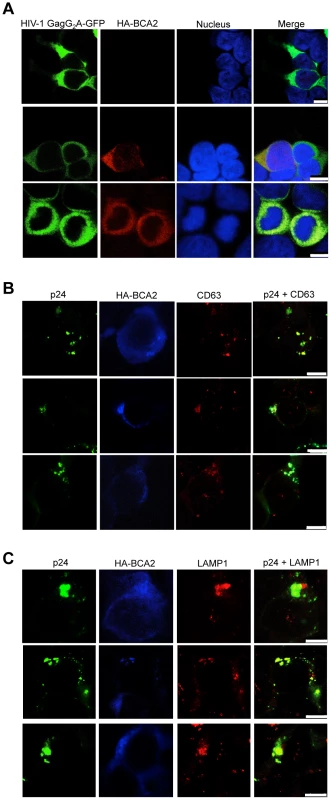 BCA2 re-distributes HIV-1 Gag, but not HIV-1 Gag G<sub>2</sub>A, to endo-lysosomal compartments.